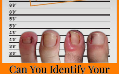 Can you identify your ingrown toenail culprit?