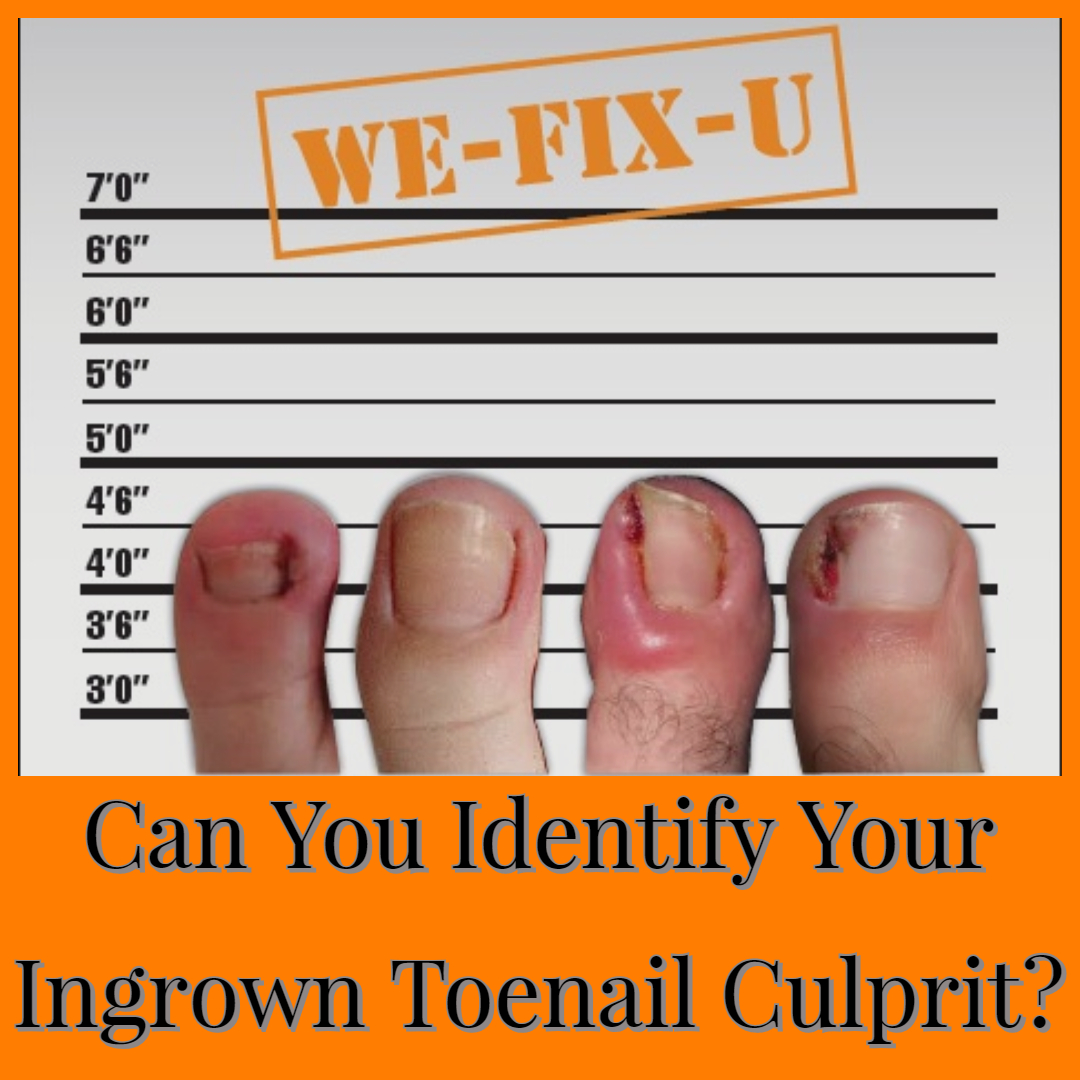 How to Cut an Ingrown Toenail