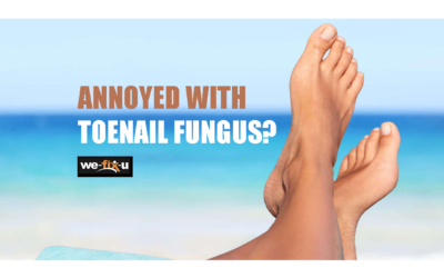 Toenail Fungus Causes and Treatment